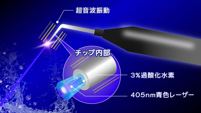 チップ内部