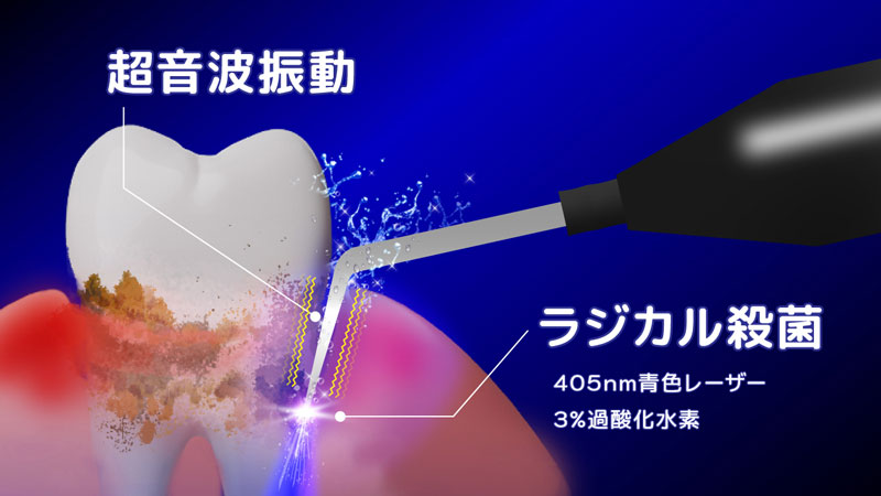 超音波振動