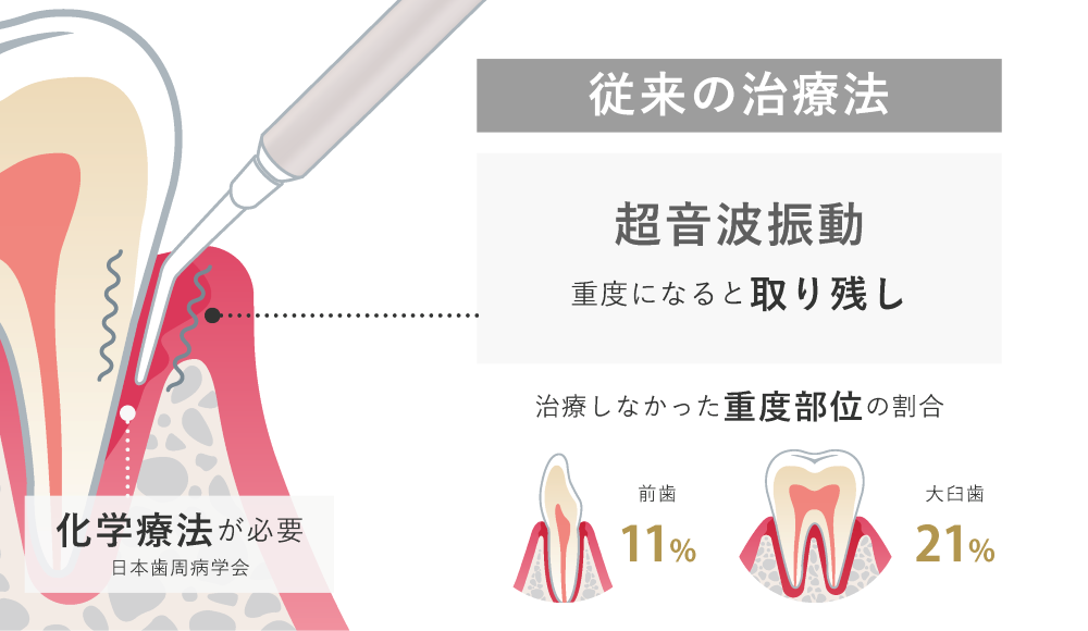 化学療法